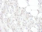 TDP43 Antibody in Immunohistochemistry (Paraffin) (IHC (P))