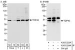 TDP43 Antibody in Western Blot (WB)