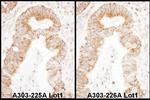 TFAM Antibody in Immunohistochemistry (Paraffin) (IHC (P))