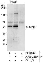 TXNIP Antibody in Immunoprecipitation (IP)