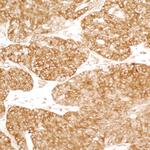 YB1 Antibody in Immunohistochemistry (Paraffin) (IHC (P))