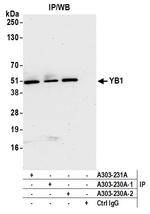 YB1 Antibody in Immunoprecipitation (IP)