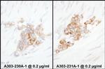 YB1 Antibody in Immunohistochemistry (Paraffin) (IHC (P))