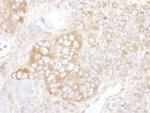 YB1 Antibody in Immunohistochemistry (Paraffin) (IHC (P))