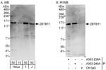 ZBTB11 Antibody in Western Blot (WB)