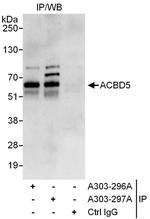 ACBD5 Antibody in Immunoprecipitation (IP)