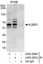 ACBD5 Antibody in Immunoprecipitation (IP)