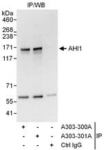 AHI1 Antibody in Immunoprecipitation (IP)