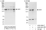 AHI1 Antibody in Western Blot (WB)