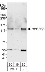 CCDC66 Antibody in Western Blot (WB)