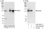 DDX42 Antibody in Western Blot (WB)