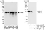 DDX42 Antibody in Western Blot (WB)