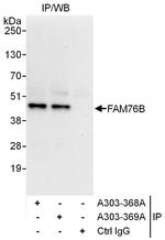 FAM76B Antibody in Immunoprecipitation (IP)