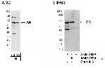 GR Antibody in Western Blot (WB)