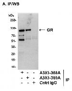 GR Antibody in Immunoprecipitation (IP)