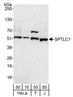 SPTLC1 Antibody in Western Blot (WB)