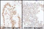 Lamin-A/C Antibody in Immunohistochemistry (Paraffin) (IHC (P))