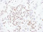 Lamin-A/C Antibody in Immunohistochemistry (Paraffin) (IHC (P))