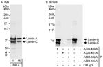 Lamin-A/C Antibody in Western Blot (WB)