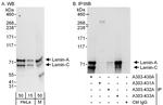 Lamin-A/C Antibody in Western Blot (WB)