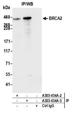 BRCA2 Antibody in Immunoprecipitation (IP)