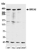 BRCA2 Antibody in Western Blot (WB)