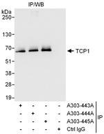 TCP1 Antibody in Immunoprecipitation (IP)