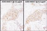 TCP1 Antibody in Immunohistochemistry (Paraffin) (IHC (P))