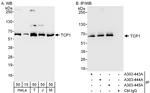 TCP1 Antibody in Western Blot (WB)