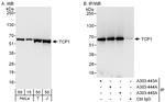 TCP1 Antibody in Western Blot (WB)