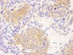 CCT8 Antibody in Immunohistochemistry (Paraffin) (IHC (P))