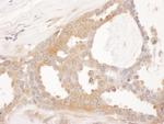 CCT8 Antibody in Immunohistochemistry (Paraffin) (IHC (P))