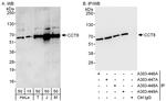 CCT8 Antibody in Western Blot (WB)