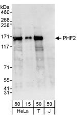 PHF2 Antibody in Western Blot (WB)