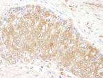 CCT3 Antibody in Immunohistochemistry (Paraffin) (IHC (P))