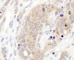 CCT3 Antibody in Immunohistochemistry (Paraffin) (IHC (P))