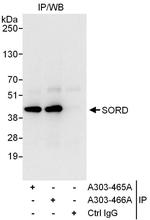 SORD Antibody in Immunoprecipitation (IP)