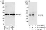 SORD Antibody in Western Blot (WB)