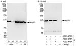 AARS Antibody in Western Blot (WB)