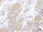 CCT2 Antibody in Immunohistochemistry (Paraffin) (IHC (P))