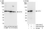 CCT2 Antibody in Western Blot (WB)