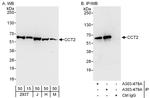 CCT2 Antibody in Western Blot (WB)