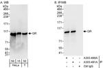 GR Antibody in Western Blot (WB)