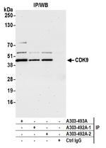 CDK9 Antibody in Immunoprecipitation (IP)