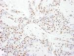 CDK9 Antibody in Immunohistochemistry (Paraffin) (IHC (P))