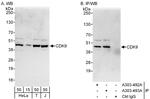 CDK9 Antibody in Western Blot (WB)