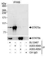 STAT5a Antibody in Immunoprecipitation (IP)