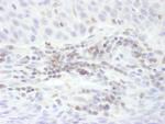 STAT5b Antibody in Immunohistochemistry (Paraffin) (IHC (P))