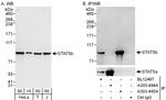 STAT5b Antibody in Western Blot (WB)