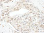 Cyclin T1 Antibody in Immunohistochemistry (Paraffin) (IHC (P))